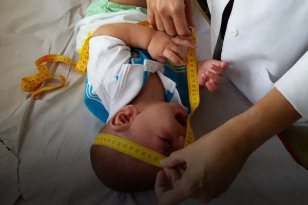 INSS pagará indenização de R$ 60 mil a crianças vítimas de zika